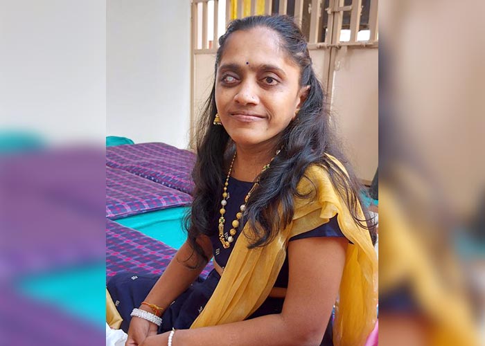 Transforming lives: Oculoplasty Success Story